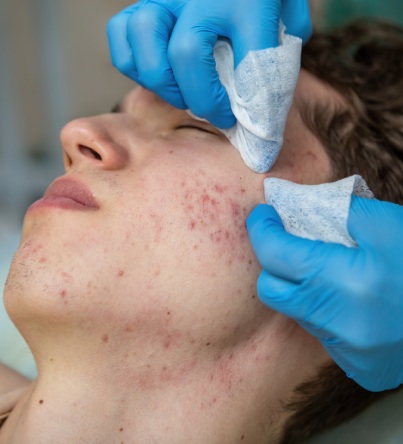skin treatment image
